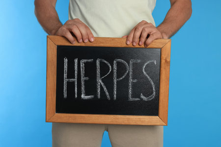 Man holding small chalkboard with word Herpes on light blue backgroundの写真素材