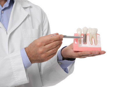 Dentist holding educational model of dental implant on white background, closeupの写真素材
