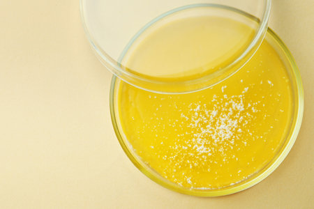Petri dish with bacteria colony on beige background, top view