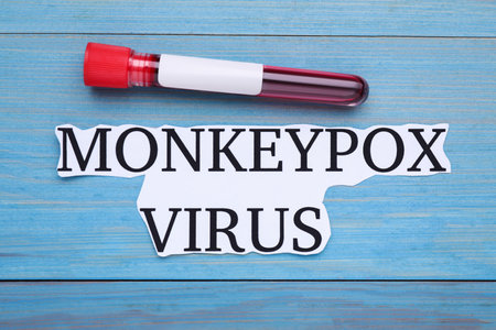 Card with words Monkeypox Virus and test tube on light blue wooden table, flat lay