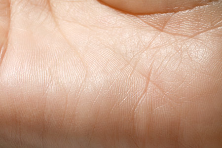Close up view of human hand with dry skin