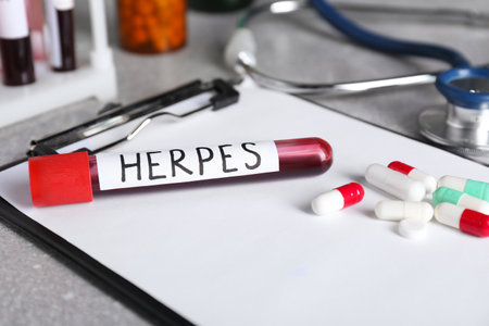Test tube with word Herpes, different pills and clipboard on light gray tableの写真素材