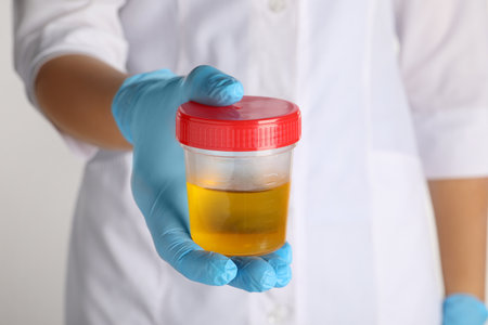Nurse holding container with urine sample for analysis on white background, closeupの写真素材