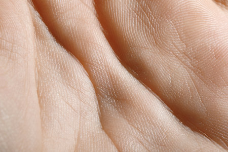 Close up view of human hand with dry skinの写真素材