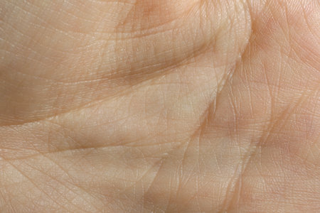 Close up view of human hand with dry skinの写真素材