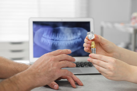 Doctor showing patient educational model of dental implant in clinic, closeup