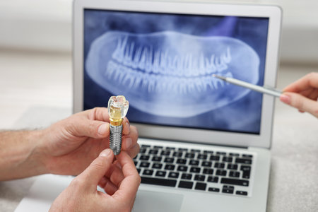 Doctor showing patient X-ray picture and educational model of dental implant in clinic, closeup