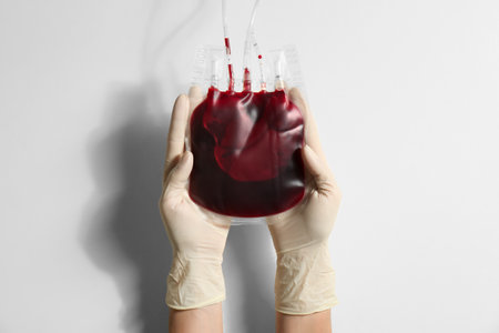 Woman holding blood for transfusion on light background, closeup. Donation conceptの写真素材
