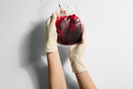 Woman holding blood for transfusion on light background, closeup. Donation conceptの写真素材
