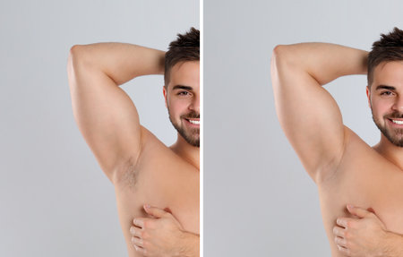 Collage of man showing armpit before and after epilation on light gray backgroundの写真素材