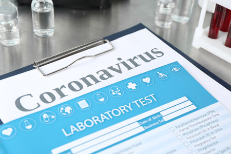 Clipboard with laboratory test list and word CORONAVIRUS on gray table, closeupの写真素材