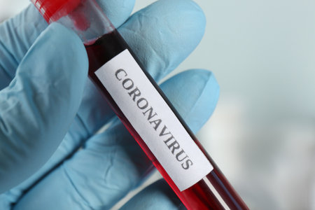 Doctor holding test tube with blood sample and label CORONAVIRUS in laboratory, closeup of handの写真素材