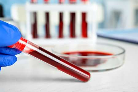 Scientist holding test tube with blood sample at table, closeup. virus researchの写真素材
