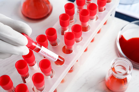 Scientist taking test tube with blood sample and label CORONA VIRUS from rack in laboratory, closeup