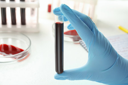 Scientist holding test tube with blood sample, closeup. laboratory analysisの写真素材