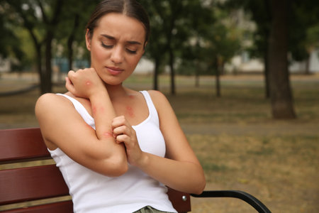 Woman scratching arm with insect bite in park. Space for textの写真素材