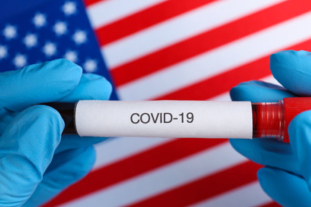 Scientist holding test tube with blood sample over American flag, closeup. Coronavirus pandemic in USAの写真素材