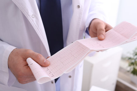 Doctor examining cardiogram in medical clinic, closeup