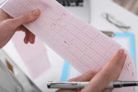 Doctor examining cardiogram in medical clinic, closeupの写真素材