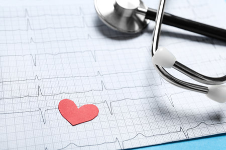 Cardiogram report with red paper heart and stethoscope on light blue background, closeupの写真素材