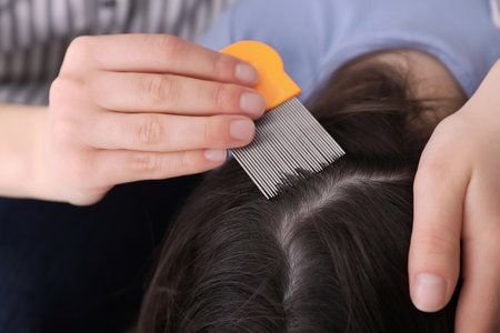 Mother using nit comb on her daughter's hair indoors. Anti-lice treatmentの写真素材