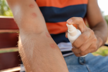 Man spraying insect repellent on his arm outdoors, closeupの写真素材