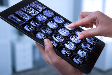 Doctor examining x-ray images on tablet indoors, closeupの写真素材