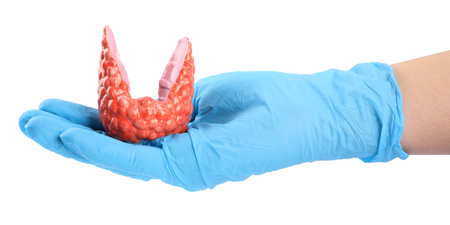 Doctor holding plastic model of affected thyroid on white background, closeup