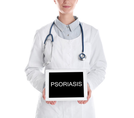 Doctor holding tablet with word PSORIASIS on white backgroundの写真素材
