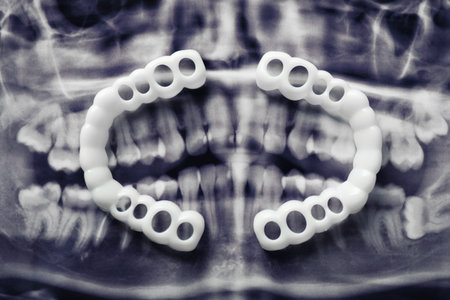 Mouth guards on dental scan, flat lay. Bit correctionの写真素材