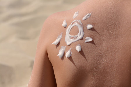 Sun drawn with sunscreen on child's back at beach, closeup