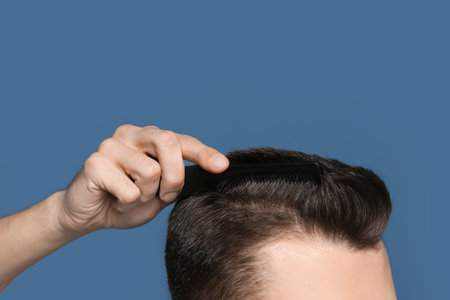 Young man with hair loss problem on color backgroundの写真素材