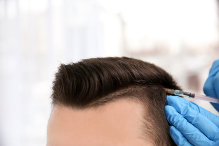 Young man with hair loss receiving problem injection on blurred background, closeupの写真素材