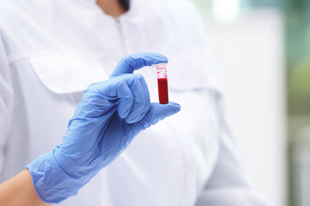 Scientist holding test tube with blood sample in laboratoryの写真素材