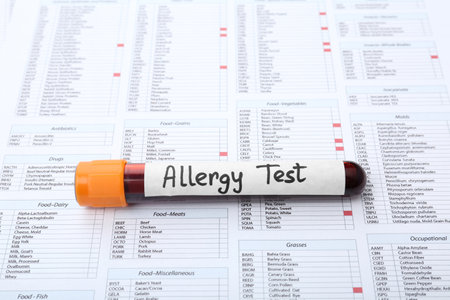 Glass tube with blood on document. allergy testの写真素材