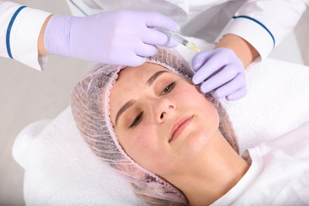 Woman undergoing face biorevitalization procedure in salon. cosmetic treatmentの写真素材