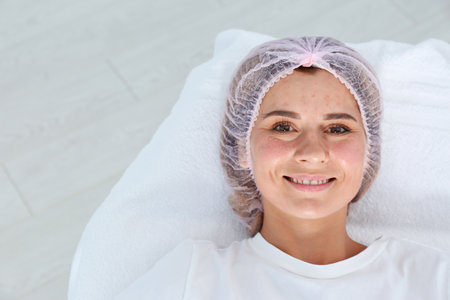 Woman after face biorevitalization procedure in salon. cosmetic treatmentの写真素材