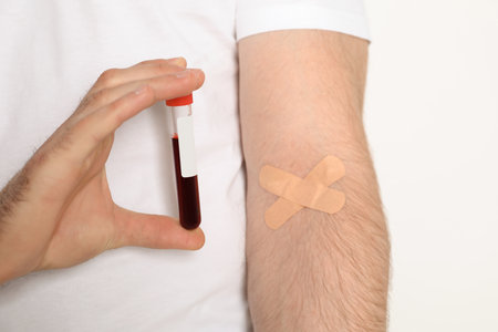 Man holding test tube near hand with adhesive plasters against white background, closeup. blood...