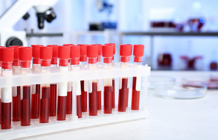 Test tubes with blood samples for analysis on table in laboratory. Space for textの写真素材