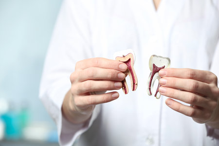 Dentist holding model of tooth on blurred background, closeupの写真素材