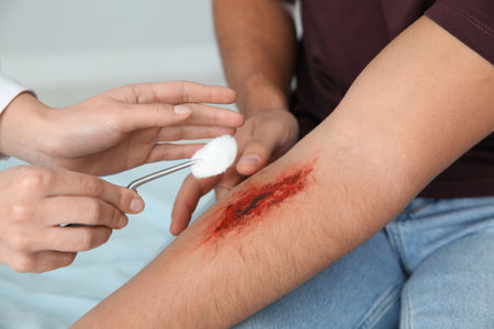 Female doctor cleaning young man's arm injury in clinic, closeup. First aidの写真素材