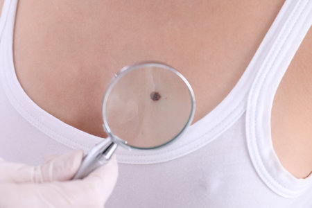 Dermatologist examining patient with magnifying glass in clinic, closeup viewの写真素材
