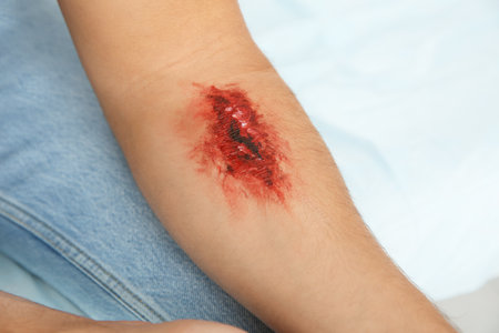 Young man with injured arm in clinic, closeup. First aidの写真素材