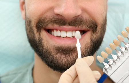 Dentist matching young man's teeth color with palette, closeupの写真素材
