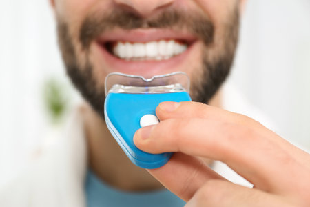 Young man using teeth whitening device on light background, closeupの写真素材