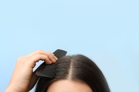 Woman with comb and dandruff in her dark hair on color background, closeup. Space for textの写真素材