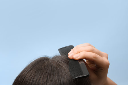 Woman with comb and dandruff in her dark hair on color background, closeup. Space for textの写真素材