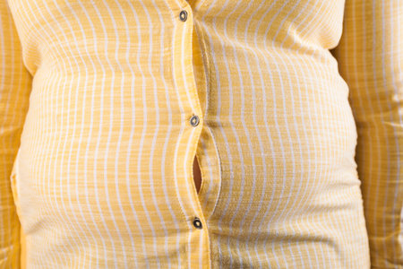 Overweight woman in tight shirt, closeup. Obesity and weight lossの写真素材