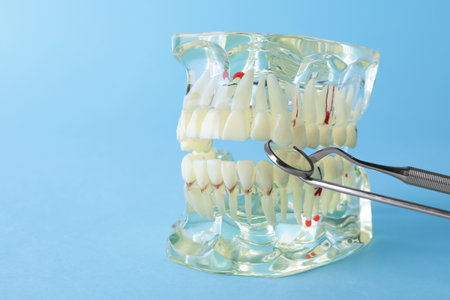 Model of oral cavity with teeth and dentist tools on color background. Space for text