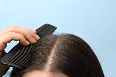 Woman with comb and dandruff in her dark hair on color background, closeupの写真素材